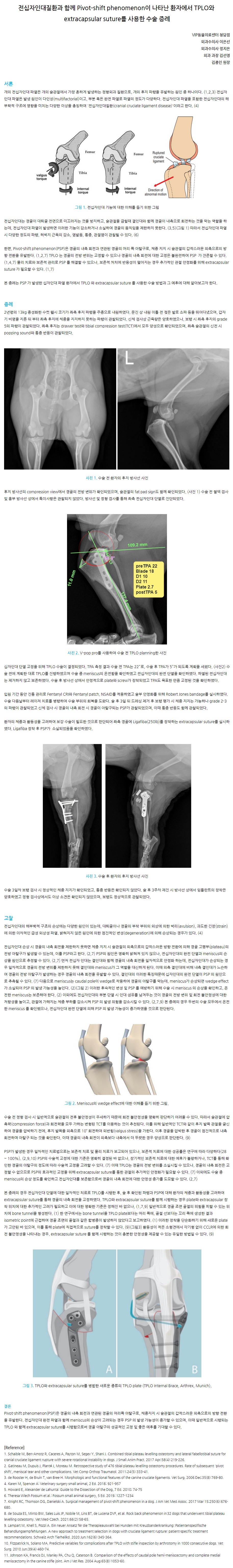 전십자인대질환과 함께 Pivot-shift phenomenon이 나타난 환자에서 TPLO와 extracapsular suture를 사용한 수술 증례.JPG