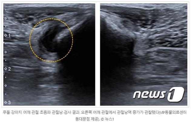 뉴스원 4.jpg