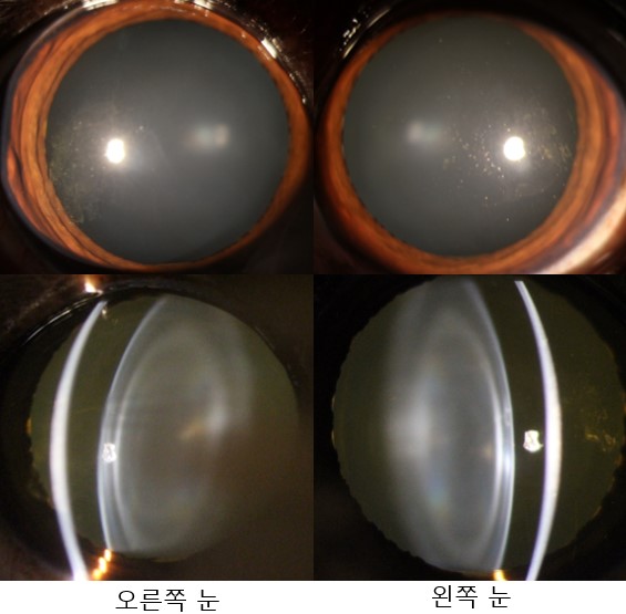 강아지 시력저하 1.jpg