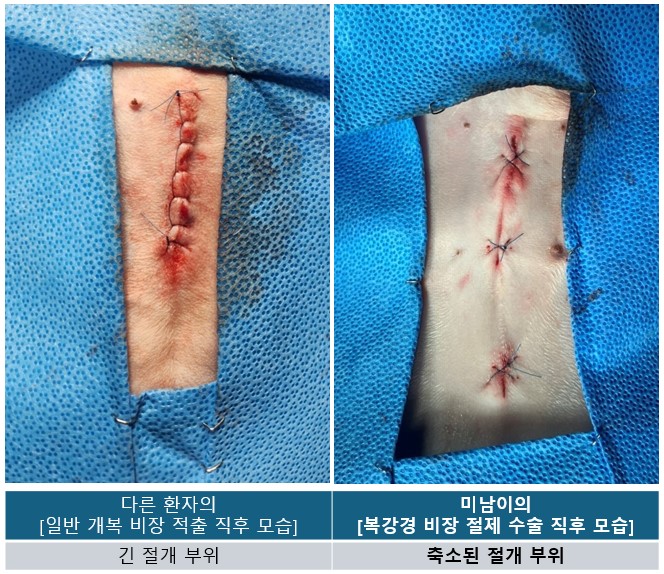 강아지 복강경 비장 절제수술 7.jpg