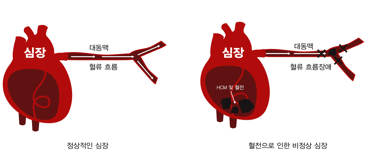 심장.PNG
