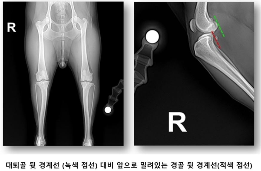 인대01.JPG