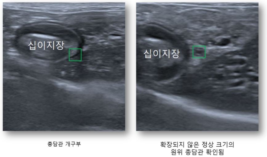 왕자06.JPG