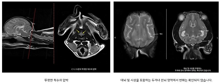 경추이상03.JPG