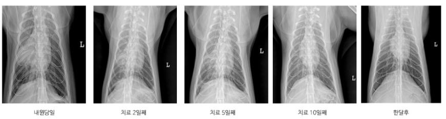 호흡곤란03.JPG