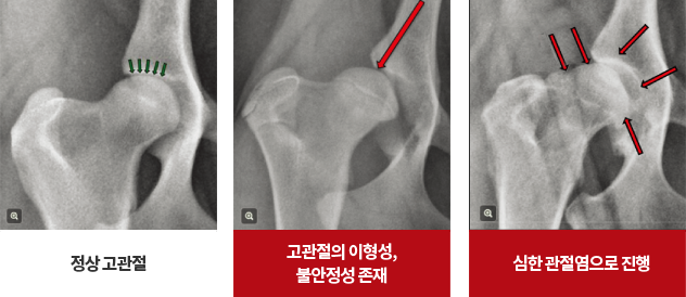 강아지 고관절 이형성증 예시 이미지