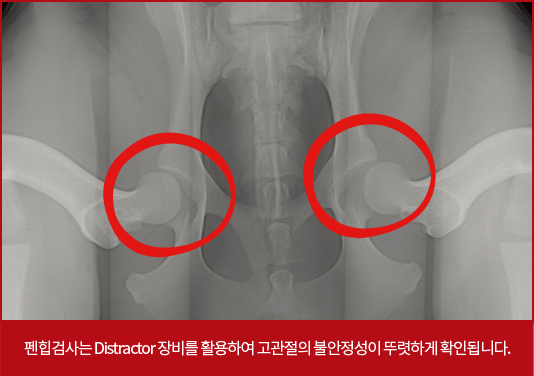 펜힙검사 이미지